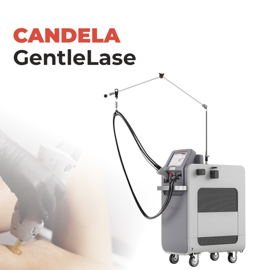 Серия GentleLase от Candela